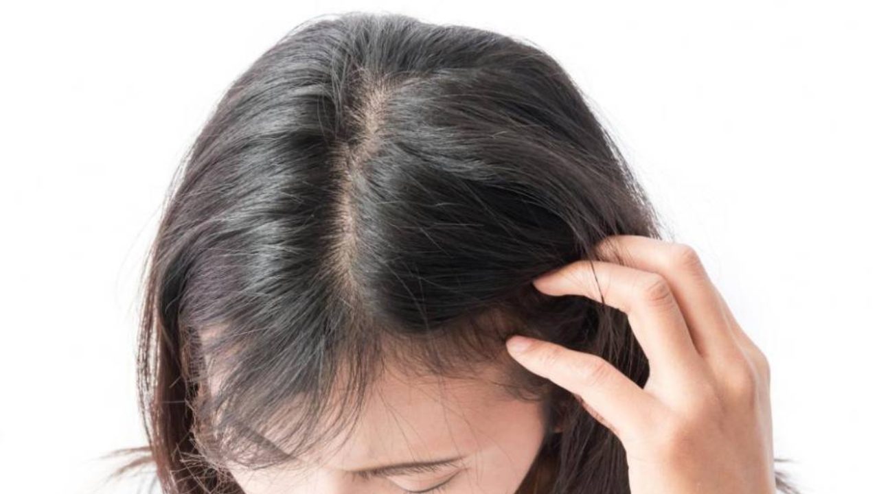 Hair Care Tips: উকুনের সমস্যা দূর হবে সহজেই, হাতে তুলে নিন পাঁচটি ঘরোয়া টোটকা