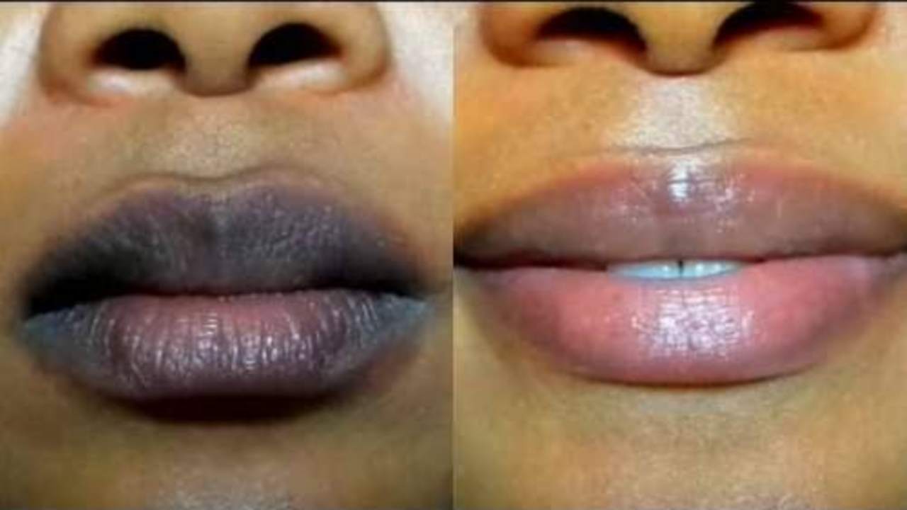 Lip Care Tips: ঠোঁট কালচে ভাব দূর করুন ৫টি পদ্ধতিতে
